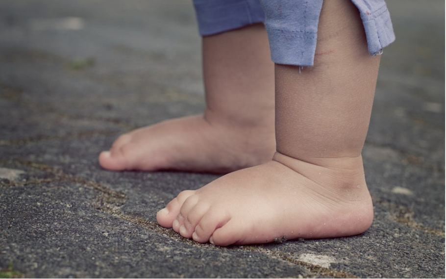 Why Do Some Babies Have Flat Feet?